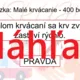RISKUJ! - Prvá pomoc pri krvácaní 4