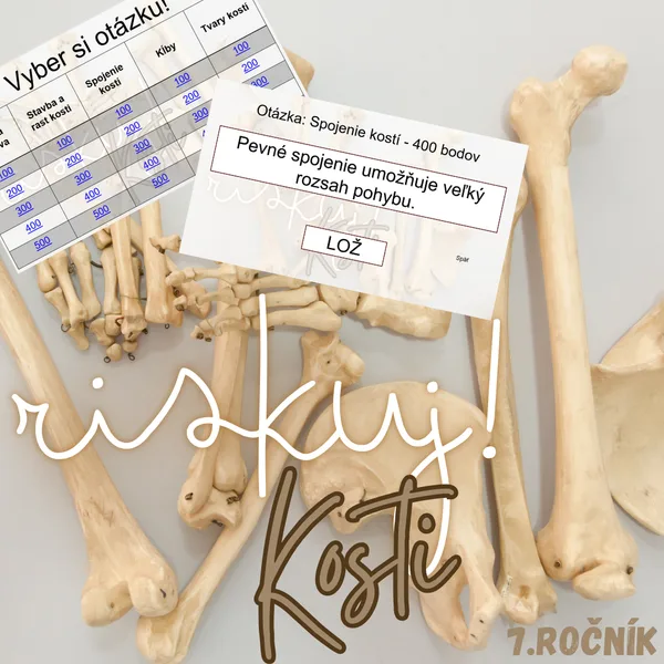 RISKUJ! - Kosti