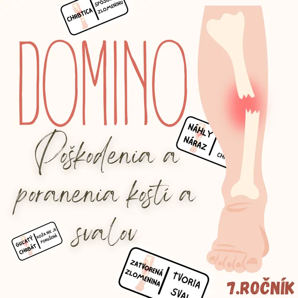 Domino - Poškodenia a poranenia kostí a svalov
