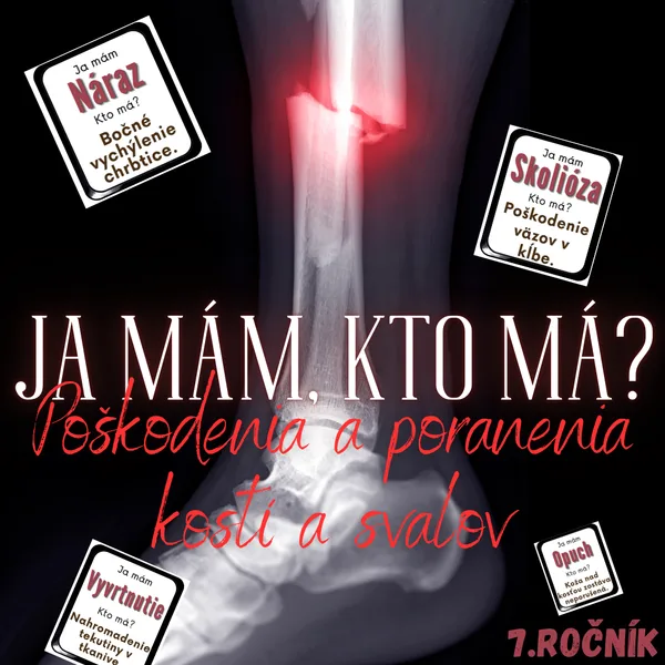 Ja mám, kto má? - Poškodenia a poranenia kostí a svalov